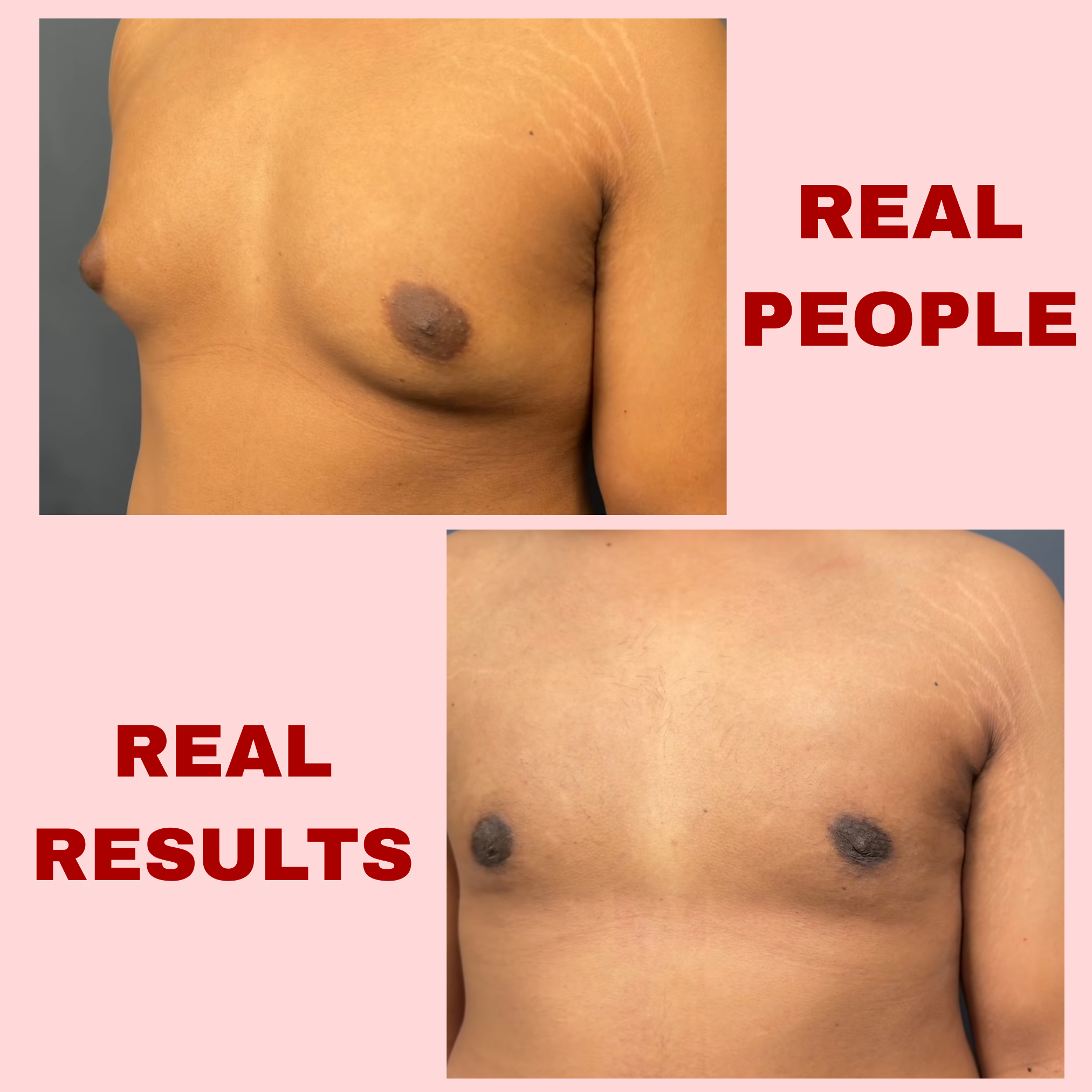 Vedafil's Gynecomastia Burner (60 Capsules)