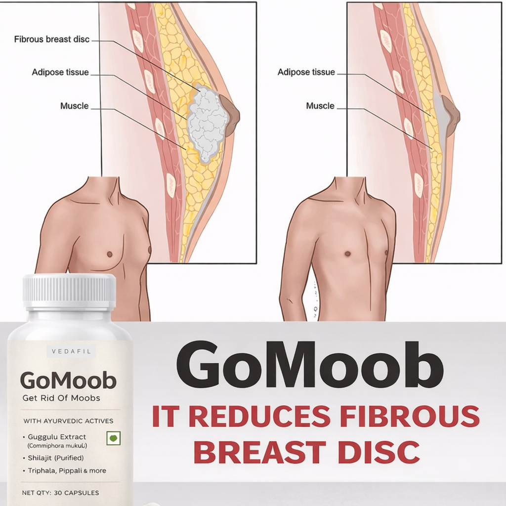 Vedafil's Gynecomastia Burner (60 Capsules)